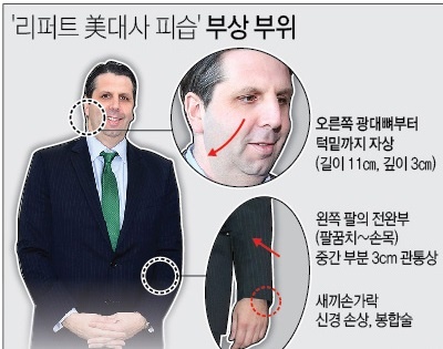 ↑마크 리퍼트 주한 미국 대사가 서울 세종문화회관에서 습격당했다. 분쟁 지역이 아닌 곳에서 미국 대사가 습격당한 것은 한국이 처음이다. 