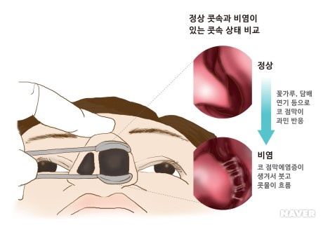 자료=네이버지석