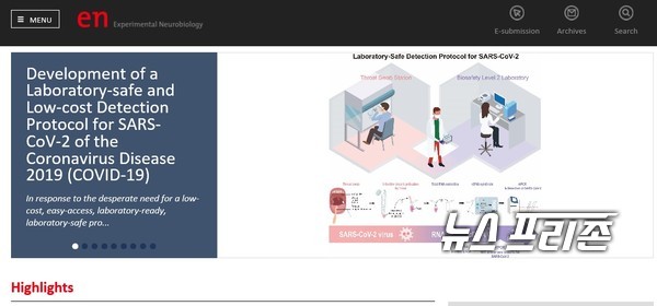 한국뇌신경과학회와 한국퇴행성신경질환학회는 11일 기초과학연구원(IBS) 인지 및 사회성 연구단 인지 교세포과학 그룹 이창준 단장 연구팀에서 연구한 ‘코로나19 바이러스를 검출할 수 있는 프로토콜’과 관련한 연구성과를 학술지에 공개했다./ⓒ익스페리멘털 뉴로바이올로지(Experimental Neurobiology)