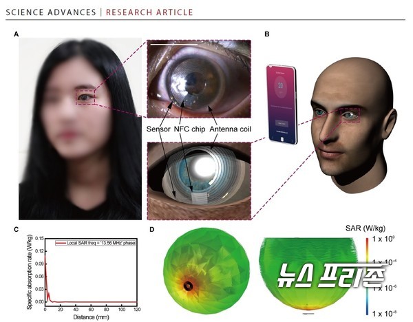 눈물 속 스트레스 호르몬을 감지해 측정할 수 있는 스마트 콘택트렌즈를 개발한 기초과학연구원(IBS) 나노의학 연구단 등 국내 연구는 국제학술지 ‘사이언스 어드밴시스(Science Advances, IF 13.116)’에 7월 10일 게재됐다./ⓒ사이언스 어드밴시스·IBS