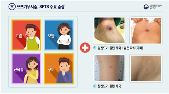 가을철, 진드기 매개 감염병 이렇게 예방하세요!./ⓒ진주시